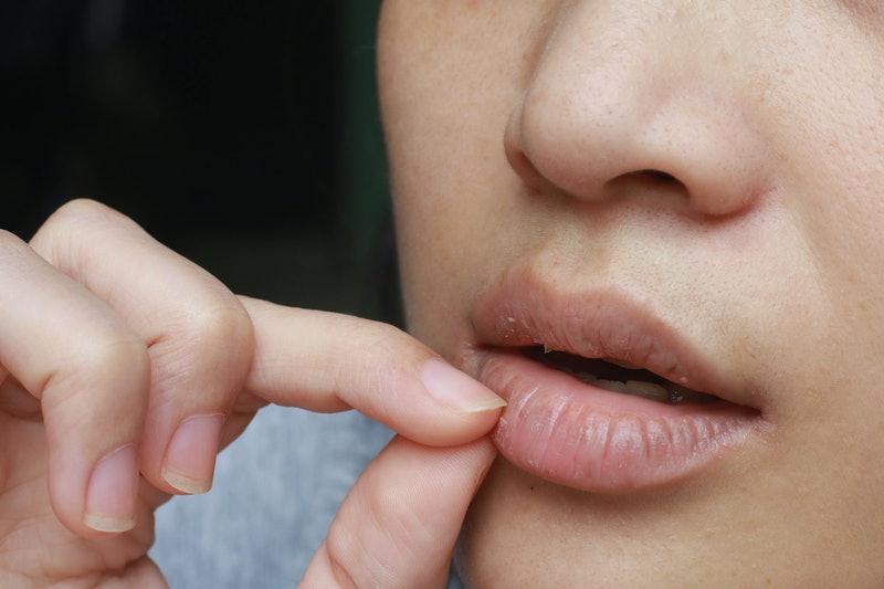 Liếm môi, bóc da môi là những thói quen xấu khiến môi thêm bong tróc, tổn thương