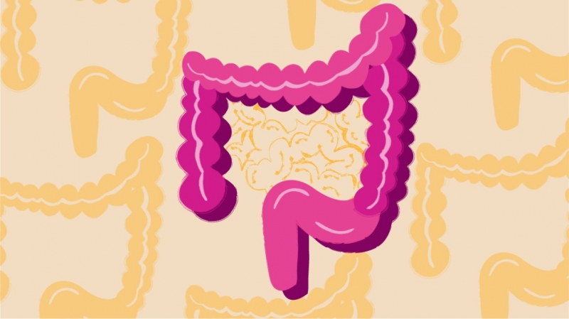 Trẻ bị bệnh Crohn nghiêm trọng cũng có thể dẫn tới hội chứng ruột ngắn
