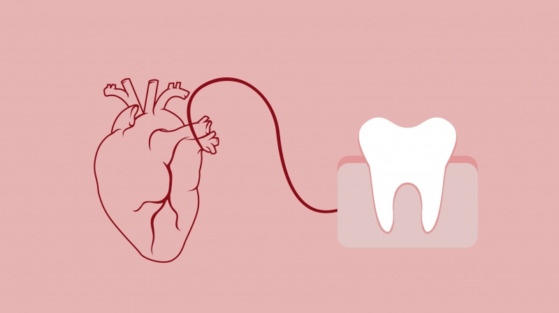 Bạn cần chú ý vệ sinh răng miệng tốt để phòng ngừa các bệnh tim mạch