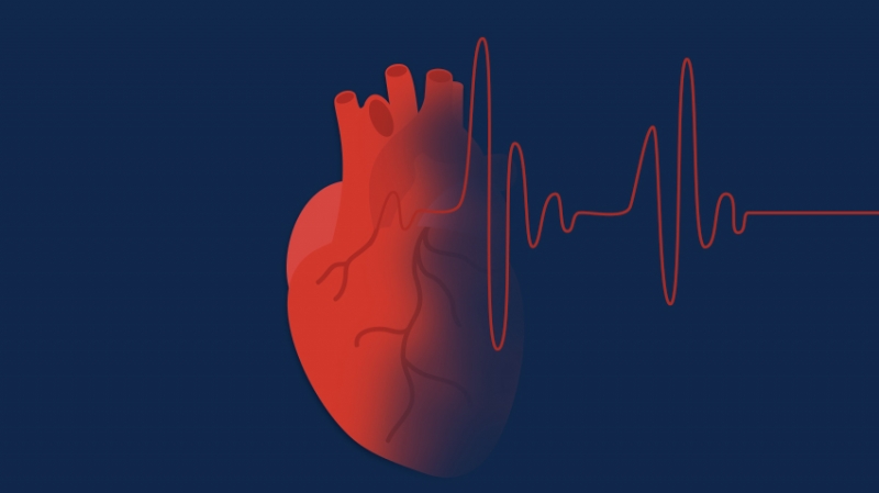 Dị tật tim bẩm sinh có thể gây ra một số biến chứng tim mạch như rối loạn nhịp tim