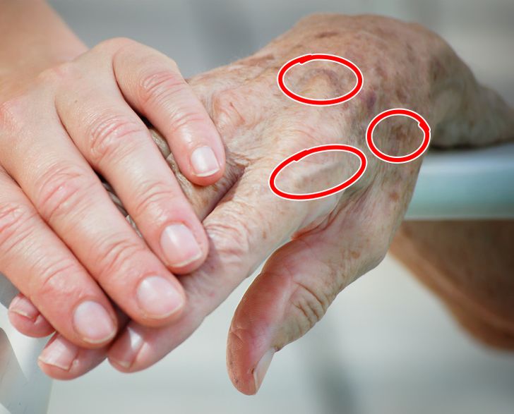 Bàn tay thường xuất hiện dấu hiệu lão hóa sớm nhất