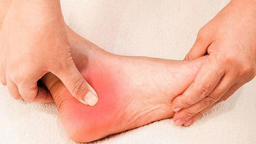 Thận bị tổn thương có thể gây sưng tấy ở bàn chân