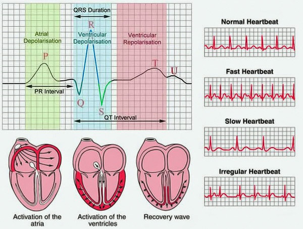 Điện tâm đồ kiểm soát rối loạn nhịp tim