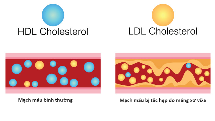 HDL-cholesterol thực hiện nhiệm vụ vận chuyển các chất béo từ trong máu về lại gan để xử lý và đào thải ra khỏi cơ thể