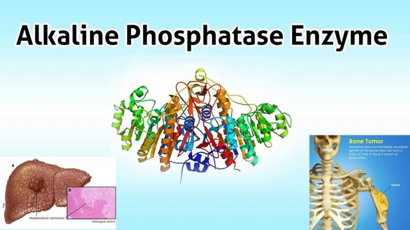 Enzyme alkaline phosphatase có tác động quan trọng tới sức khỏe xương, gan