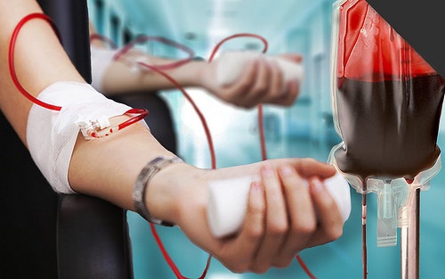 Do bị thiếu máu mạn tính, bệnh nhân tan máu bẩm sinh cần phải truyền máu định kỳ