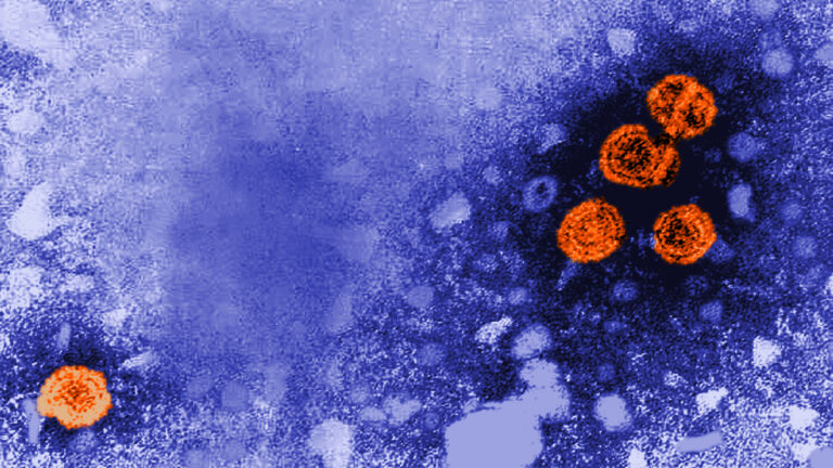 Virus viêm gan B (màu cam) được nhìn dưới kính hiển vi. Ảnh minh họa/AFP