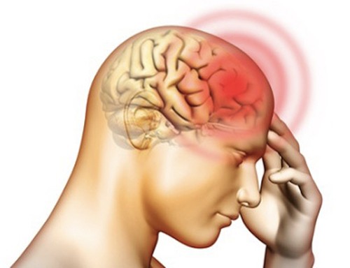 Viêm màng não có thể gây ra bởi những con sán dây - Ảnh: nhathuoclongchau.com