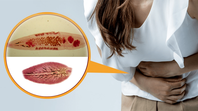 Sán lá gan thường ký sinh ở gan, đường mật, gây tổn thương nghiêm trọng cho các cơ quan này