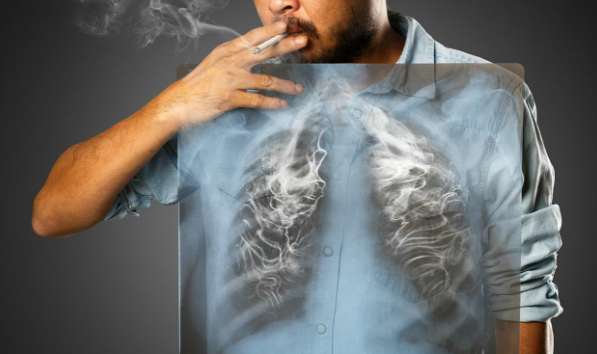 Bạn sẽ dễ mắc các bệnh về phổi như viêm phổi, tắc phổi, Ung thư phổi…. khi hút thuốc lá.