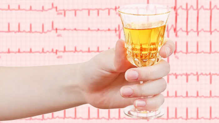 Người bệnh rung nhĩ nên tránh các thức uống có cồn như rượu bia