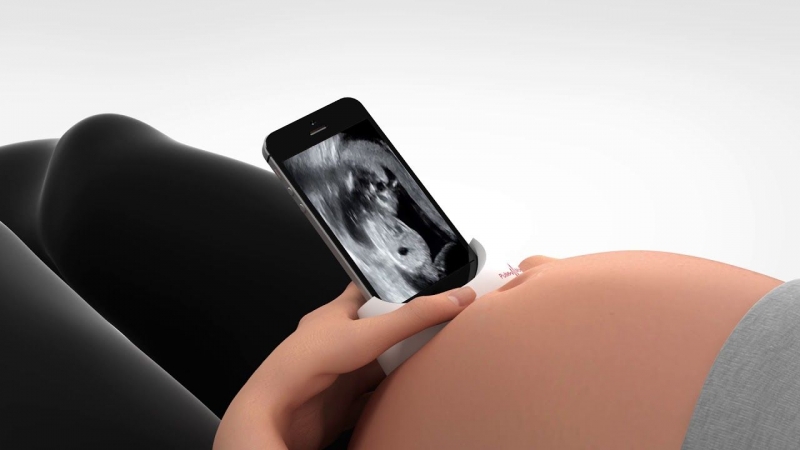Thiết bị của Pulsenmore cho phép các bác sỹ theo dõi tốt hơn các trường hợp mang thai cần chú ý đặc biệt