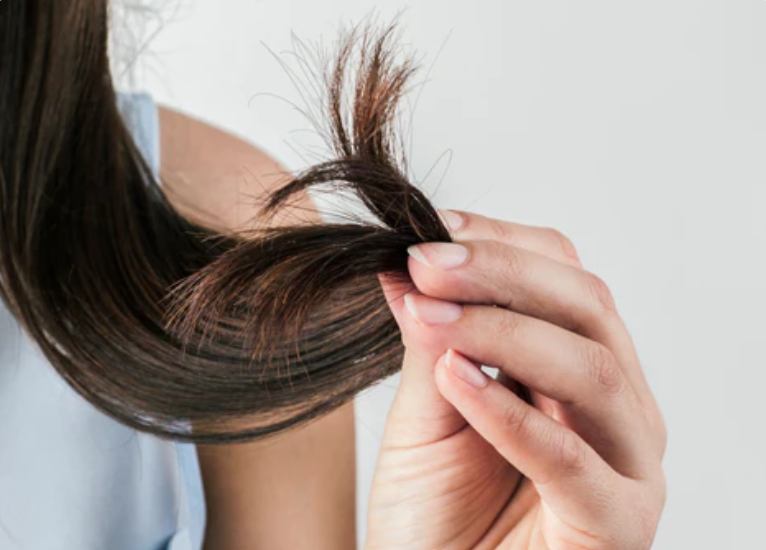 Lạm dụng dầu gội khô có thể khiến tóc khô xơ, chẻ ngọn