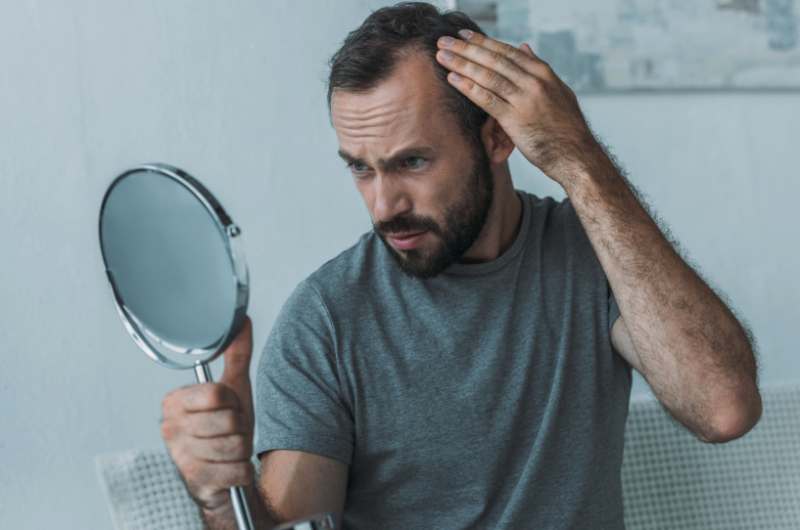 Rụng tóc, hói đầu có thể xảy ra khi nồng độ testosterone sụt giảm đột ngột
