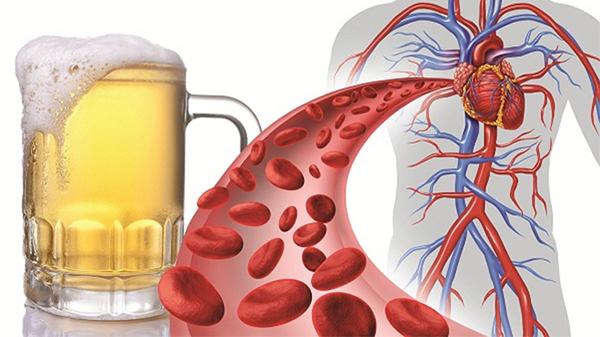 Uống nhiều rượu bia có thể khiến mỡ máu tăng cao