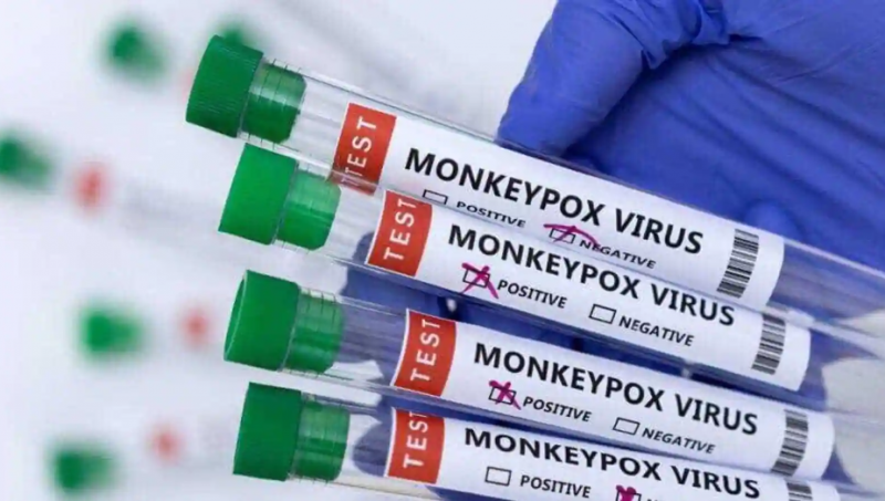 Tên gọi mới cho các biến thể virus đậu mùa khỉ là cần thiết để thúc đẩy hợp tác chống dịch bệnh