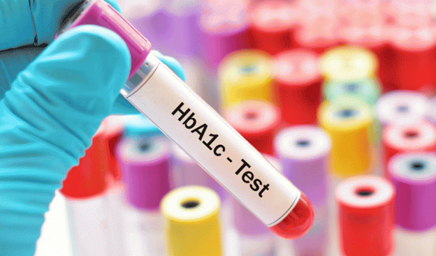 Bạn vẫn có thể ăn uống bình thường trước khi làm xét nghiệm HbA1c