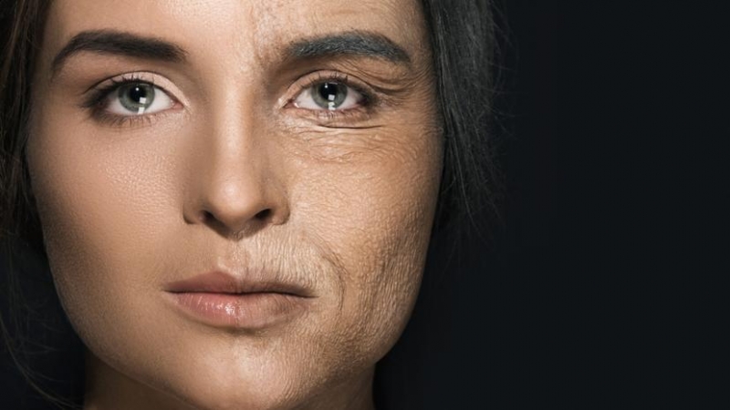 Các nhà khoa học Israel đã tìm ra cách để đảo ngược quá trình lão hóa trên da người