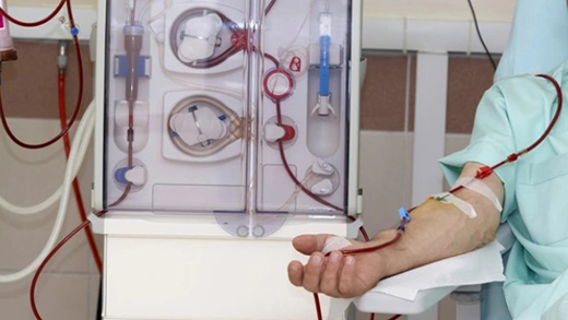 Lọc máu là một phương pháp điều trị cho bệnh nhân suy thận nặng
