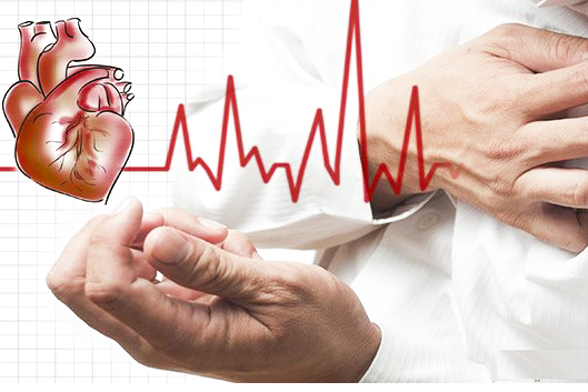 Rối loạn nhịp tim làm tăng nguy cơ đột tử