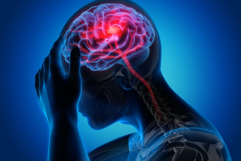 Các yếu tố thời tiết có thể ảnh hưởng tới các mạch máu ở não, gây ra đau đầu