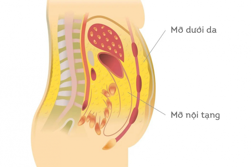Hầu hết lượng mỡ lưu trữ ở khu vực bụng của nam giới đều là mỡ nội tạng