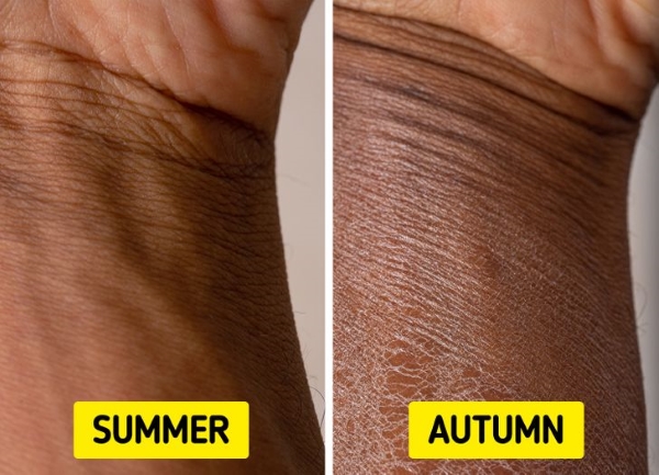 Vào mùa thu, da khô rất dễ bị thiếu ẩm gây bong tróc - Ảnh: Bright Side.