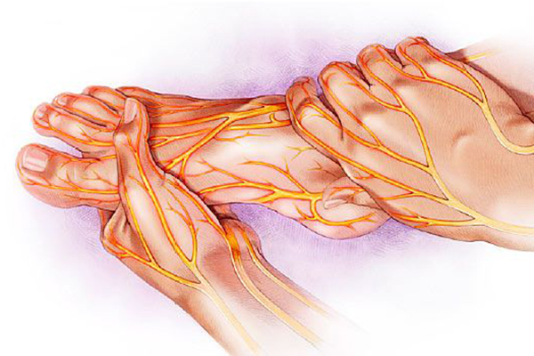 Bệnh động mạch ngoại biên xảy ra khi mảng bám tích tụ trong các động mạch cung cấp máu cho tay hoặc chân