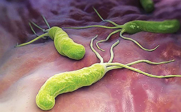 Vi khuẩn HP (Helicobacter Pylori ) - Tác nhân chính gây viêm loét dạ dày.