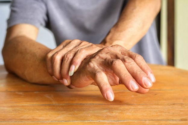 Bệnh Parkinson không phải nguyên nhân duy nhất gây ra run tay