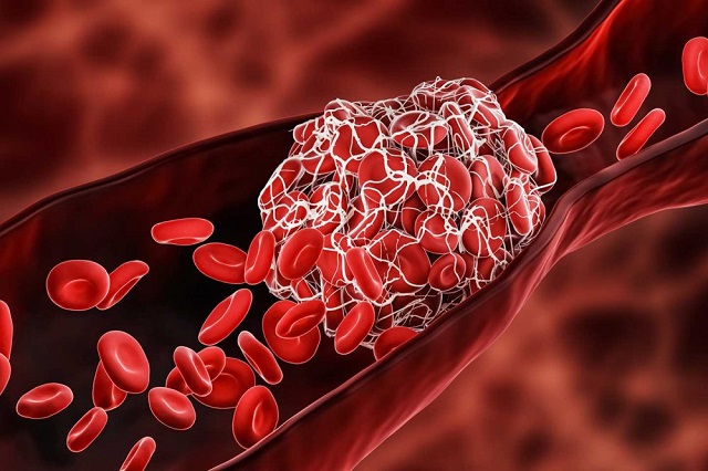 Exosome kết hợp với tiểu cầu trong tế bào sẽ kết tụ thành các tế bào máu khác nhau giống cục máu đông
