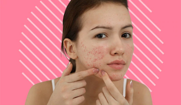 Tình trạng viêm nhiễm không kiểm soát có thể lan sang những vùng da khỏe mạnh 