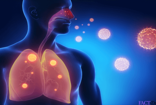 Nấm Histoplasma spp có thể gây bùng phát bệnh nhiễm trùng phổi