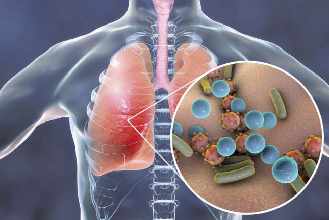 Môi trường ẩm thấp tạo điều kiện cho vi khuẩn tấn công phổi