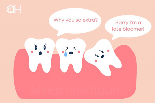 Răng khôn có thể gây ảnh hưởng đến các răng khác xung quanh 
