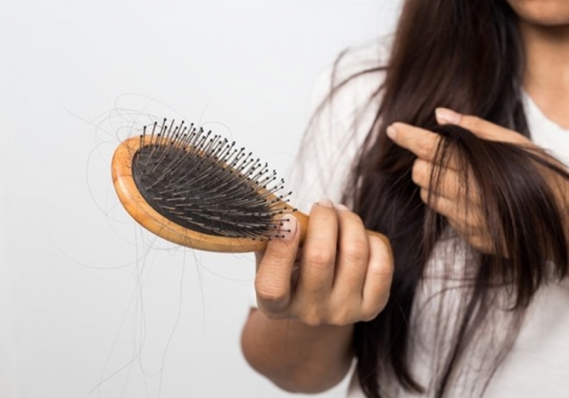 Sự thay đổi hormone sau sinh, là nguyên nhân chính gây ra tình trạng rụng tóc.