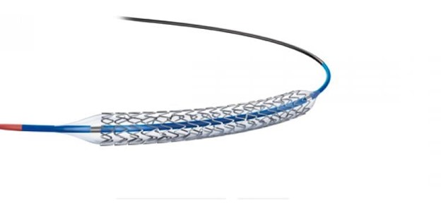 Loại stent trần, stent kim loại hiện nay ít được lựa chọn vì nguy cơ tái hẹp cao