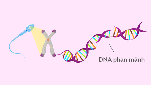 Phân mảnh DNA là một trong những bất thường di truyền của tinh trùng, chiếm 20% các trường hợp vô sinh nam