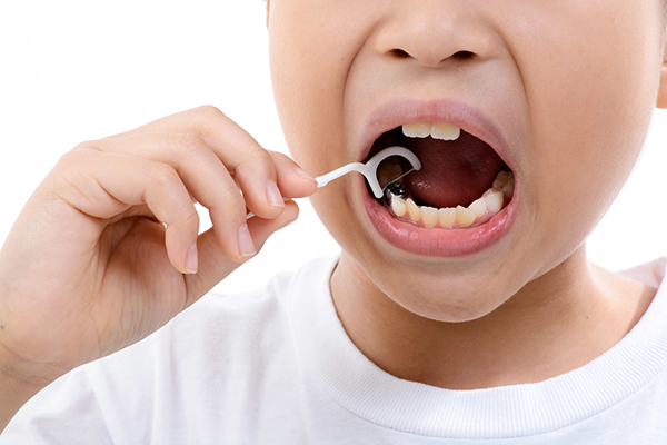 Chỉ nha khoa giúp làm sạch mảng bám giữa các kẽ răng