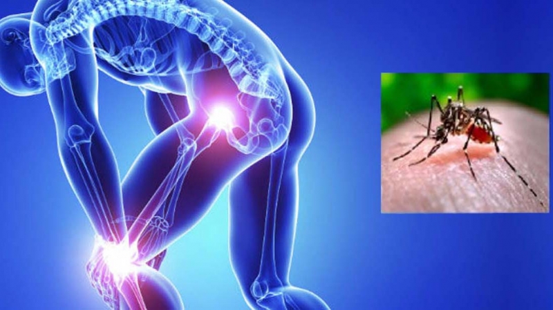 Người nhiễm virus Chikungunya do muỗi truyền có thể gặp các triệu chứng tương tự như viêm khớp