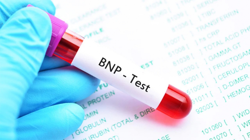 Xét nghiệm BNP đánh giá được tầm nghiêm trọng của bệnh suy tim