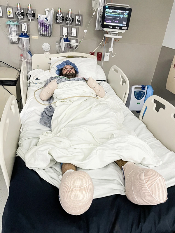 Michael Kohlhof sau ca phẫu thuật vá các vết cắt cụt chi bằng ghép da - Ảnh: Greg Kohlhof.