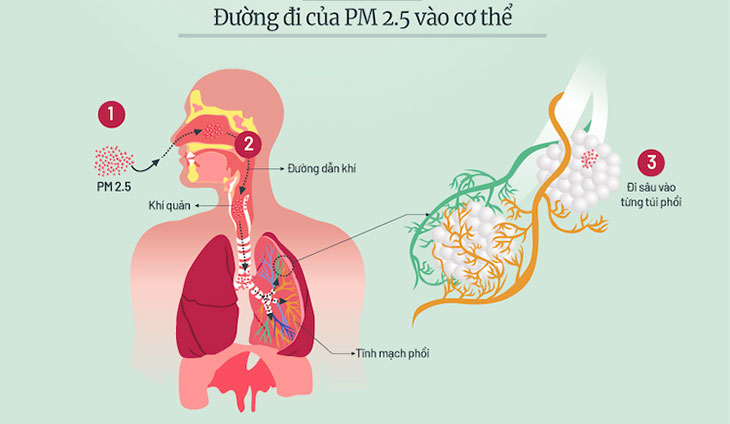 Ô nhiễm không khí do bụi mịn PM2.5 ảnh hưởng nghiêm trọng tới sức khỏe