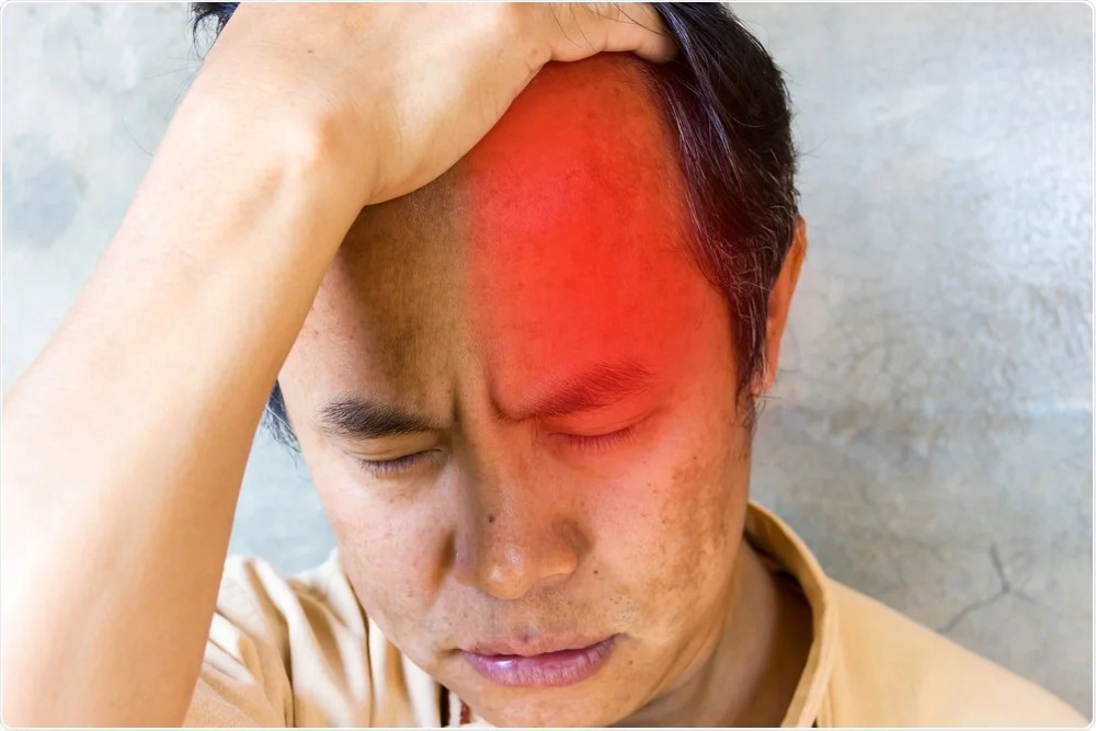 Cơn đau đầu chùm thường lan ra khu vực xung quanh hoặc bên trong một mắt