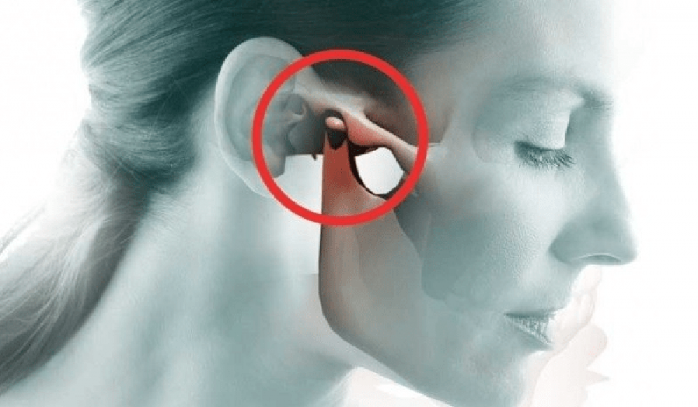 Rối loạn khớp thái dương hàm có thể gây cảm giác đau mạnh ở vùng trước tai, đau trong tai, ù tai