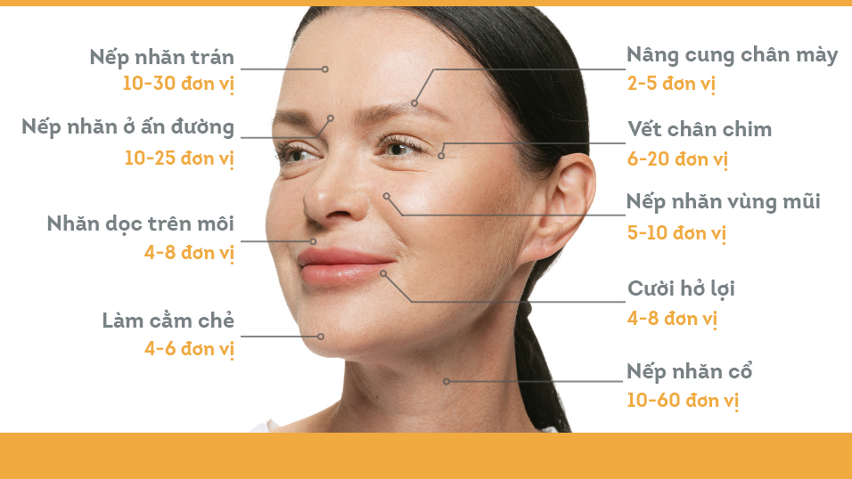 Lượng Botox cần tiêm tại từng vị trí (mỗi đơn vị phụ thuộc vào từng nhãn hiệu) - Nguồn: DermaEnvy Skincare