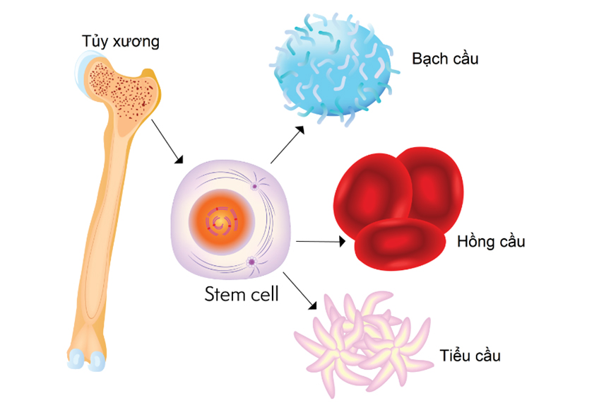 Có thể cấy ghép tế bào gốc tự thân và hoặc ghép đồng loài (từ anh em ruột, máu dây rốn hoặc bố mẹ)
