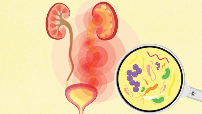 Các vi khuẩn gây nhiễm trùng đường tiết niệu có thể liên quan đến niệu đạo, tuyến tiền liệt, bàng quang hoặc thận