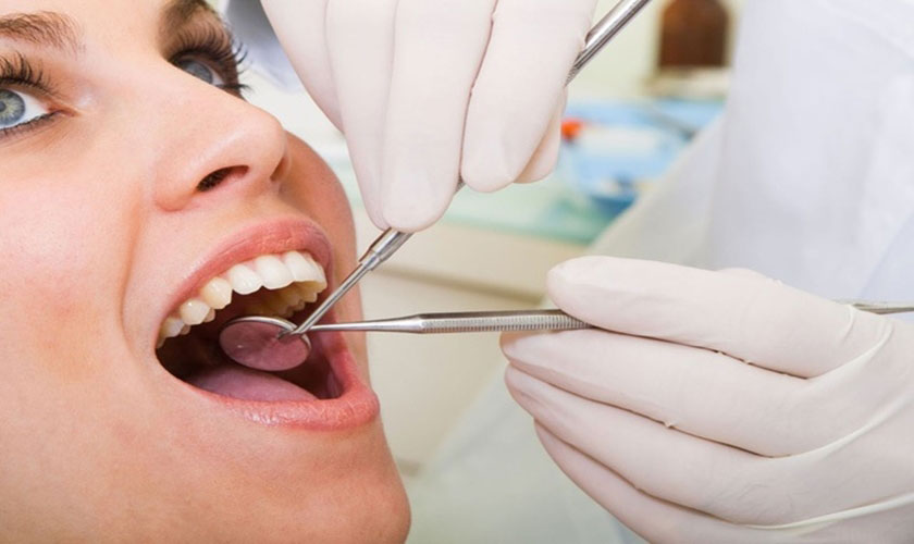 Viêm quanh răng cần được điều trị tại chỗ bằng cách kiểm soát mảng bám răng, lấy cao răng 3 tháng 1 lần