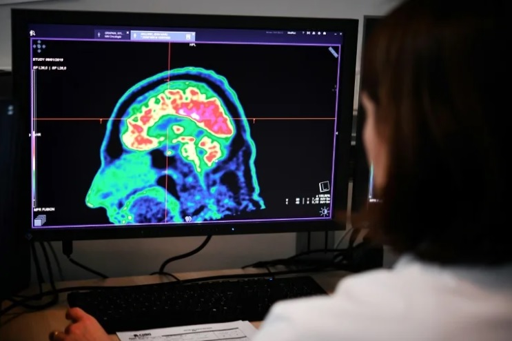 Những đột phá mới trong y khoa thế giới đã mang lại hy vọng cho những trẻ em mắc khối u não hiếm gặp DIPG - Ảnh: Fred TANNEAU
